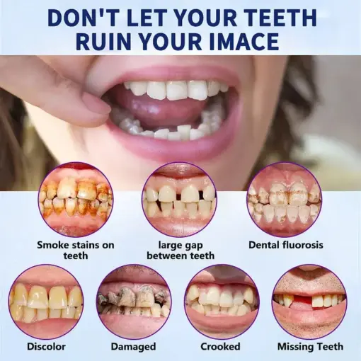 TAILEDEN™-New Generation Flexible Full Denture Solution