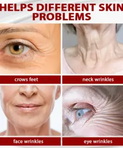 HZA™ Dragon Blood Advanced RepairSerum