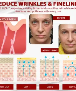 HZA™ Dragon Blood Advanced RepairSerum