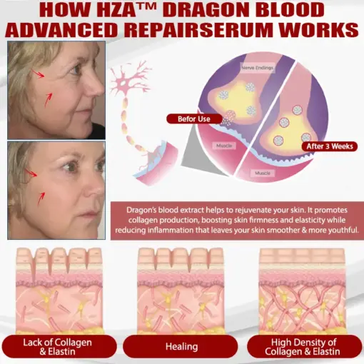HZA™ Dragon Blood Advanced RepairSerum