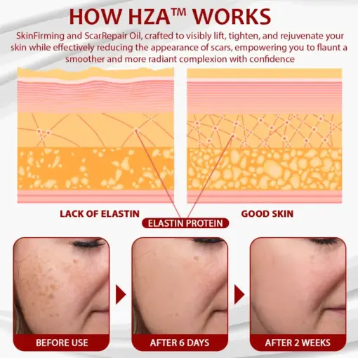 HZA™ Dragon Blood Advanced RepairSerum